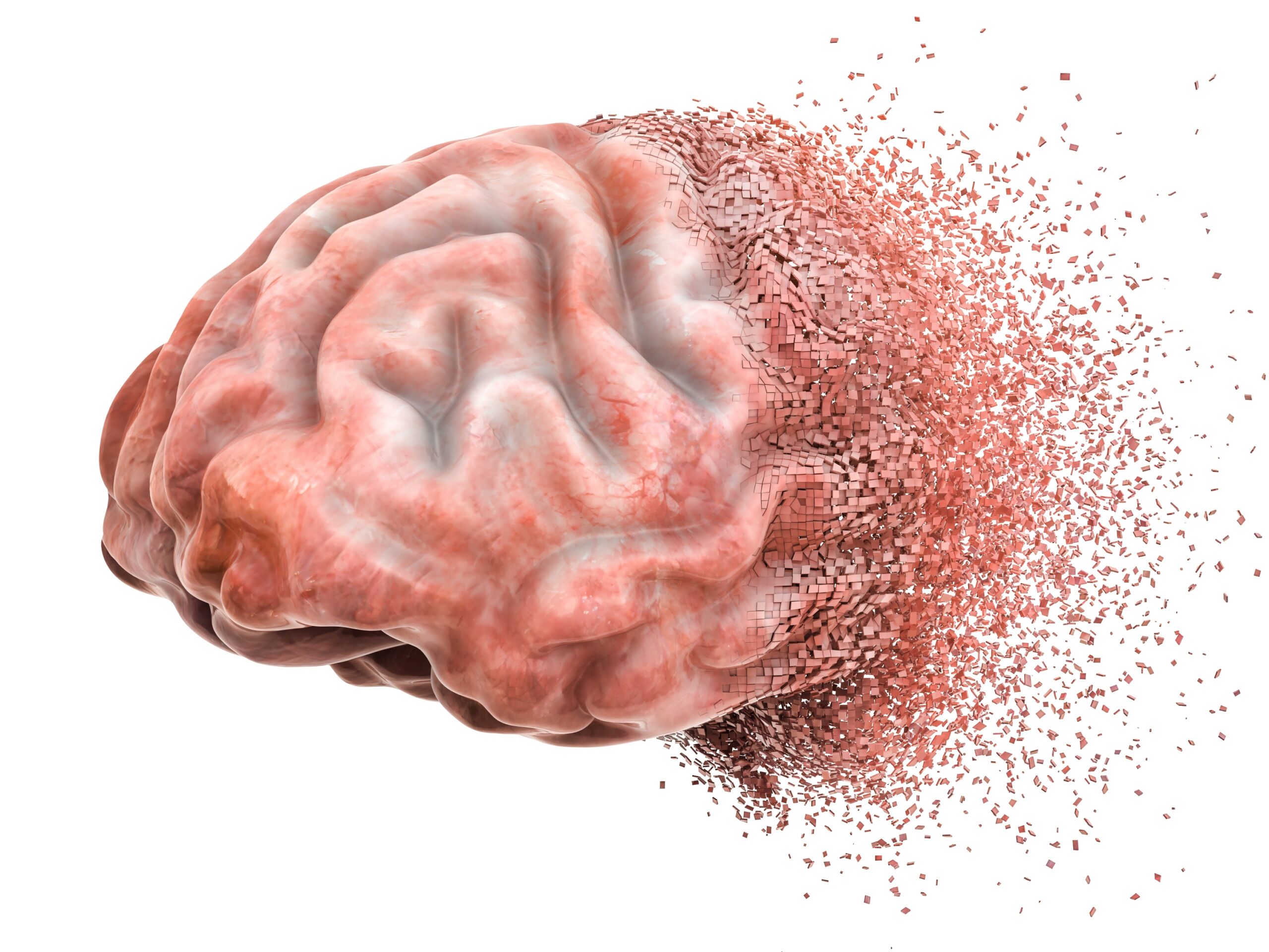 What happens in the brain under legal LSD? 